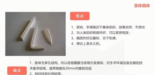 用什么材料隆鼻最自然,哪种材料做隆鼻最自然图7